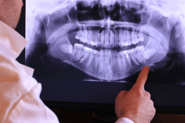 Best Knocked-Out Tooth Emergency  in Toledo, IA