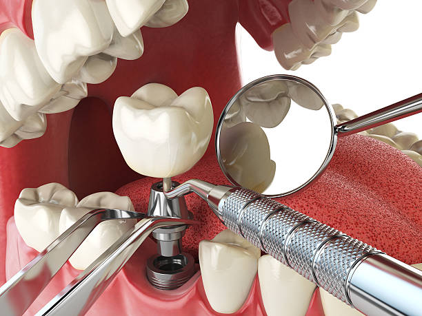 Emergency Dentist Open Today in IA